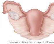 Gynecology | Uterus and surrounding anatomy