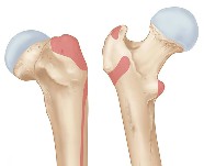 Femur muscle insertions